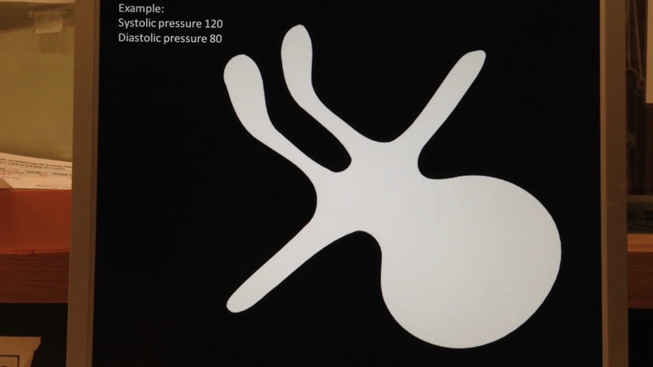 An early Visual Patient prototype pairs a changing body silhouette with an example blood pressure of 120/80 mmHg.