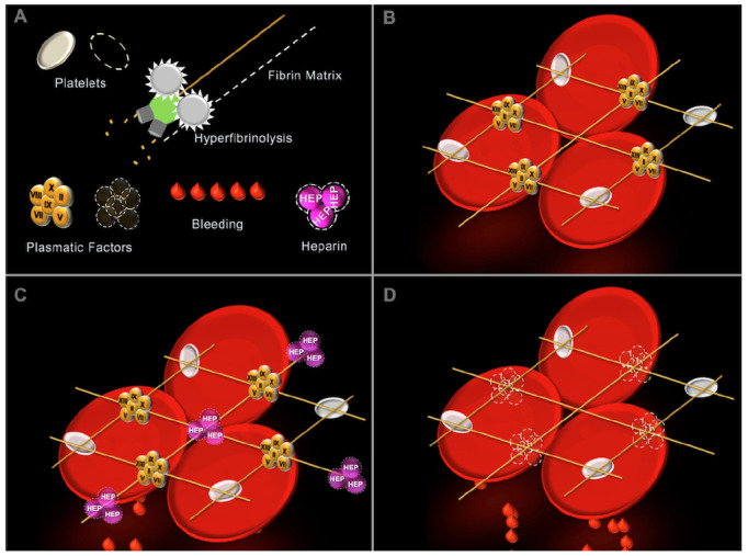 Four published Visual Clot examples illustrating clot components and different coagulation states